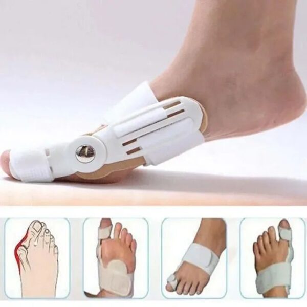 Foot Bone Correction for Relief of Thumb Valgus Toe Corrector Night Toe Splitter Adjustment Toe Foot Tool Bunion Splint - Image 3